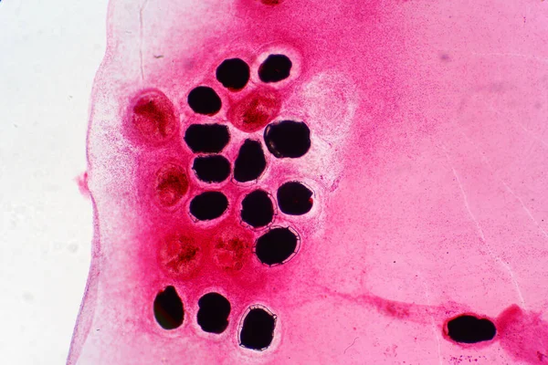 Eggs liver fluke(Parasitic flatworm) infection in fish scale.