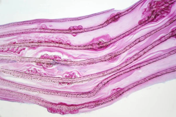 Eggs Liver Fluke Parasitic Flatworm Infección Aleta Pescado — Foto de Stock