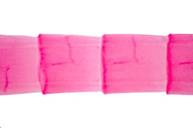 Eğitimleri için mikroskop altında sığır ve diğer otlayan hayvanların bağırsak kurdu (Parazit solucanı).