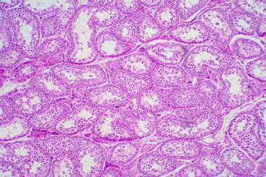 Mikroskop altında insan testisleri. Spermatogoni, mayoz, spermatid ve spermatozoa 'yı gösteriyor.