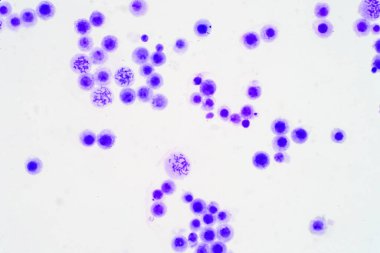 Eğitim için mikroskop altında insan kromozomları