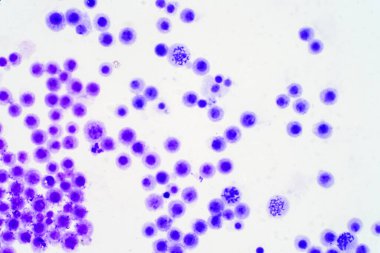 Eğitim için mikroskop altında insan kromozomları