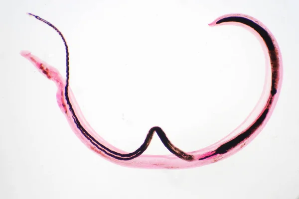 Whipworm Trichuris Trichiura Mikroskop Altında Eğitim Için Kullanılan Parazit Helminik — Stok fotoğraf