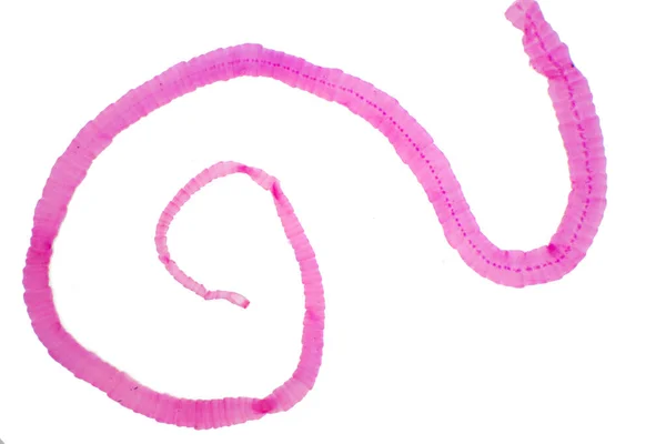 Parasitic Flatworm — ஸ்டாக் புகைப்படம்