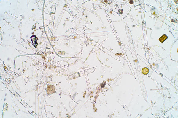 Plancton Aquatique Marin Sous Vue Microscope — Photo