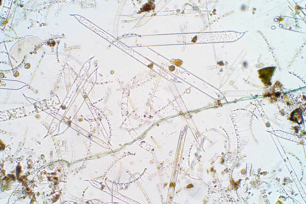 Marine aquatic plankton under the microscope view