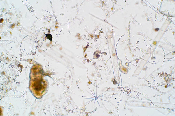 현미경으로 플랑크톤 — 스톡 사진