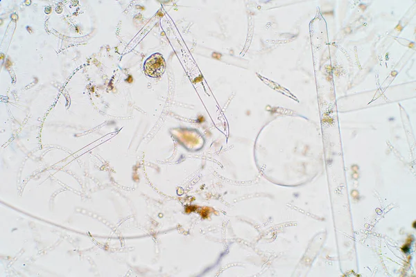 Plancton Aquatique Marin Sous Vue Microscope — Photo