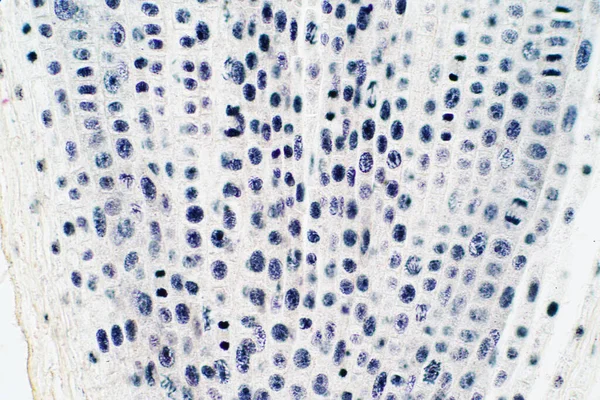 Embout Racinaire Cellule Oignon Mitose Dans Extrémité Racinaire Pour Éducation — Photo