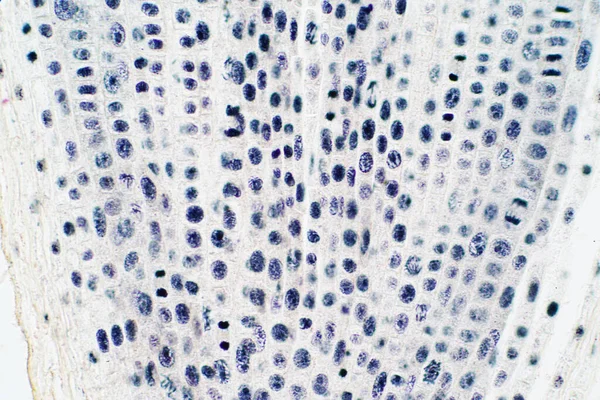 Корінь Кінчика Клітини Цибулі Мітозу Кінчику Кореня Освіти — стокове фото