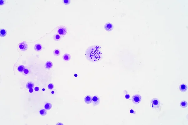 Cromosomi Umani Microscopio Educazione — Foto Stock