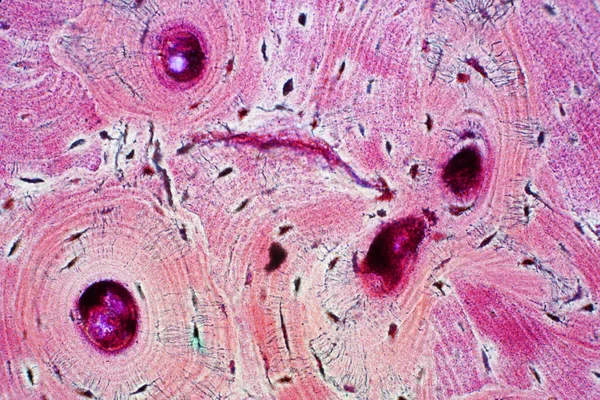 Histologi Mänsklig Kompakt Benvävnad Mikroskop Syn För Utbildning Muskelben Anslutning — Stockfoto