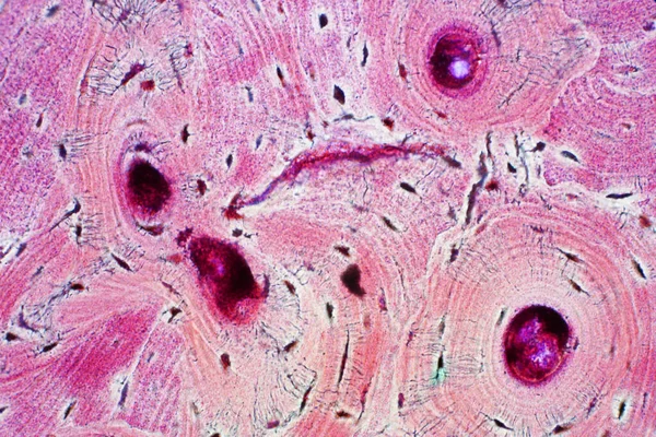 Histologie Des Menschlichen Kompakten Knochengewebes Unter Dem Mikroskop Für Ausbildung — Stockfoto