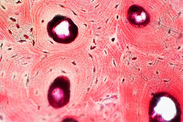 Histology of human compact bone tissue under microscope view for education, muscle bone connection and connective tissue