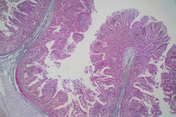 Lidská Tkáň Tlustého Střeva Pod Mikroskopem Histologické Pro Fyziologii Člověka — Stock fotografie