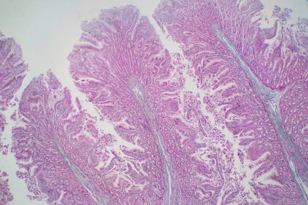 Tecido Intestinal Grosso Humano Sob Visão Microscópica Histológico Para Fisiologia — Fotografia de Stock