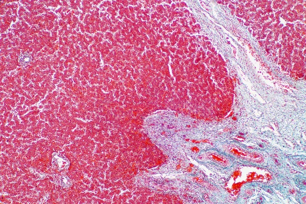 Tejido Hepático Humano Bajo Vista Del Microscopio Histológico Para Fisiología —  Fotos de Stock