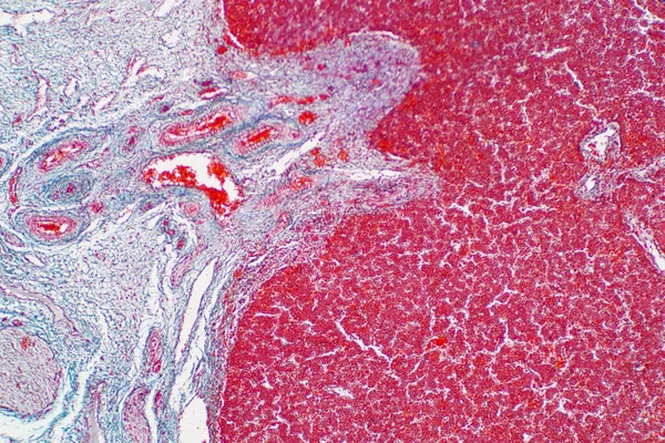 Menschliches Lebergewebe Unter Dem Mikroskop Histologisch Für Die Menschliche Physiologie — Stockfoto