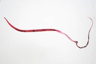 Whipworm (Trichuris trichiura), mikroskop altında eğitim için kullanılan parazit helminik nematod (yuvarlak solucan).