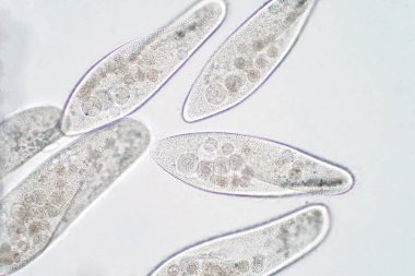 Paramesyum caudatum, mikroskop altında tek hücreli bir protozoan ve bakteri cinsidir.