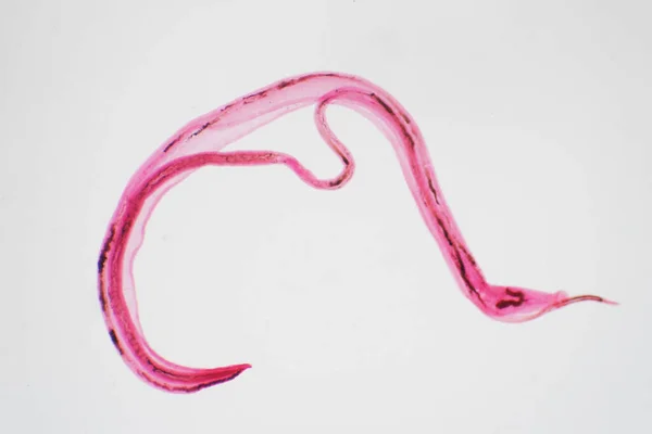 Trichuris Triichiura は寄生性の寄生虫で 教育のための顕微鏡像の下での線虫です — ストック写真