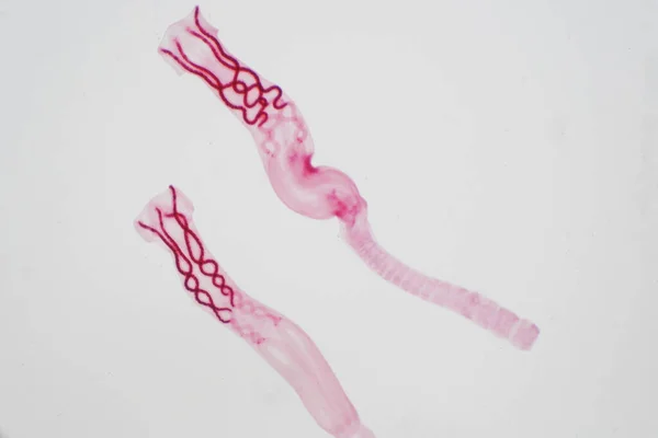 Tapeworm Gusano Plano Parásito Bovinos Otros Animales Pastoreo Bajo Microscopio —  Fotos de Stock