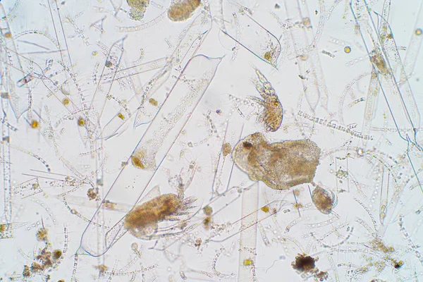 현미경으로 플랑크톤 — 스톡 사진