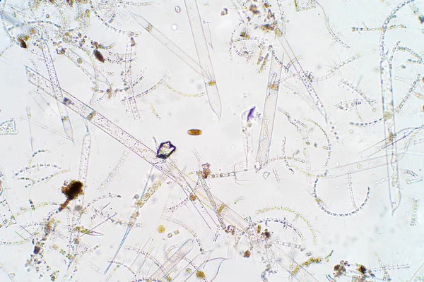 Morski Plankton Wodny Pod Mikroskopem — Zdjęcie stockowe