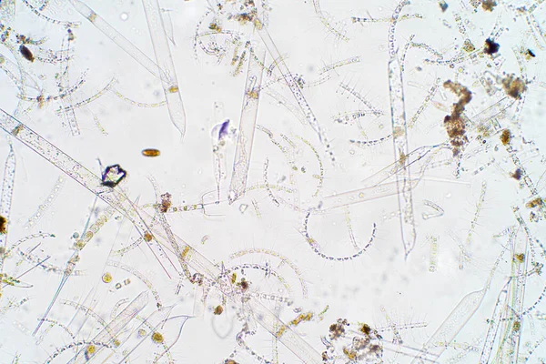 Morski Plankton Wodny Pod Mikroskopem — Zdjęcie stockowe