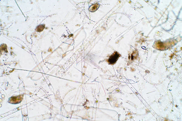 Marine aquatic plankton under the microscope view