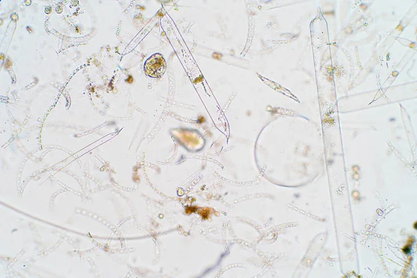 Marine aquatic plankton under the microscope view