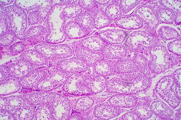 Secção Transversal Testis Humanos Sob Visão Microscópica Mostra Espermatogonia Espermatócitos — Fotografia de Stock
