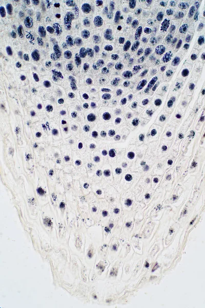 Rotspetsen Onion Och Mitosis Cell Rotspetsen För Utbildning — Stockfoto