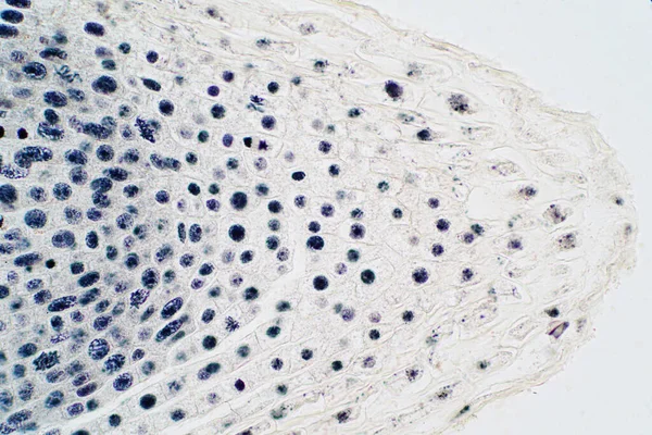 Ponta Raiz Cebola Célula Mitose Ponta Raiz Para Educação — Fotografia de Stock