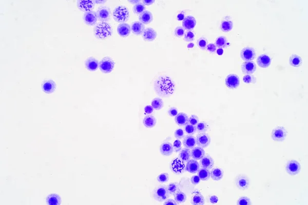 教育のための顕微鏡観察下のヒト染色体 — ストック写真