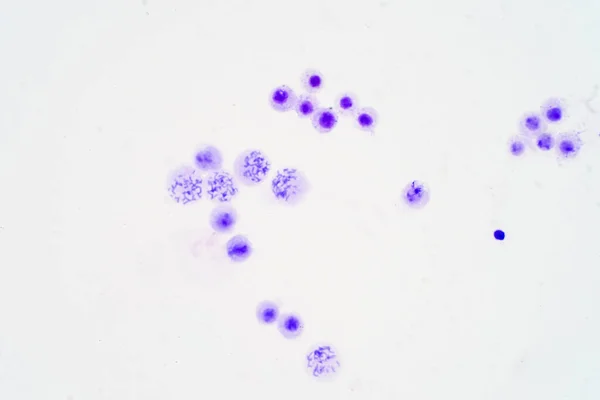 Cromosomas Humanos Bajo Microscopio Ver Para Educación — Foto de Stock