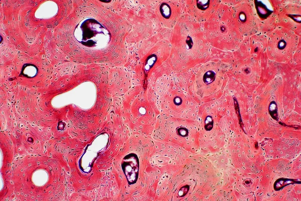 Histologi Mänsklig Kompakt Benvävnad Mikroskop Syn För Utbildning Muskelben Anslutning — Stockfoto