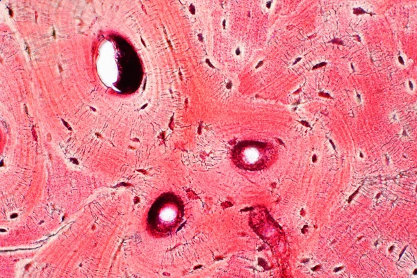 Humán Kompakt Csontszövet Szövettani Vizsgálata Mikroszkóp Alatt Oktatási Izomrendszeri Kötőszöveti — Stock Fotó