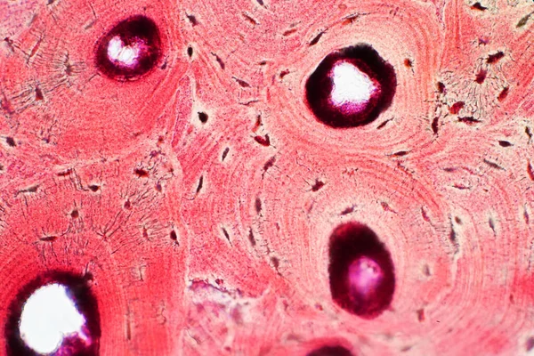 Histologia Tecido Ósseo Compacto Humano Sob Visão Microscópica Para Educação — Fotografia de Stock