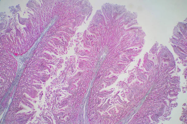 Lidská Tkáň Tlustého Střeva Pod Mikroskopem Histologické Pro Fyziologii Člověka — Stock fotografie