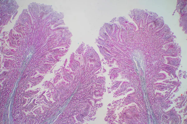 Tecido Intestinal Grosso Humano Sob Visão Microscópica Histológico Para Fisiologia — Fotografia de Stock