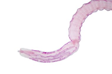 Eğitimleri için mikroskop altında sığır ve diğer otlayan hayvanların bağırsak kurdu (Parazit solucanı).