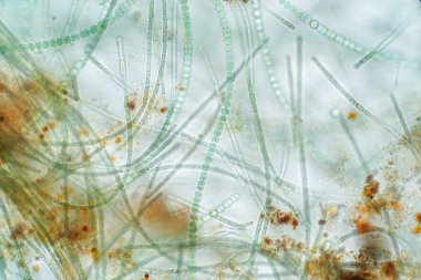Anabaena mikroskobik altında yaşayan bir alg türüdür..