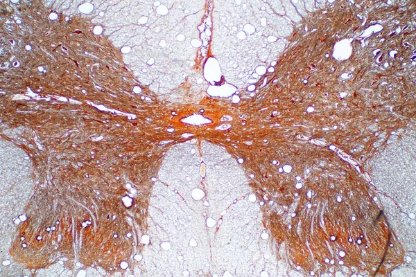 显微镜下脊髓横断面 人类生理学的组织学 — 图库照片