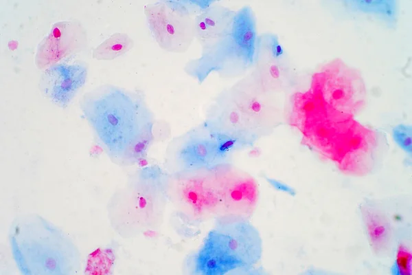 Plaveiselcelepitheelcellen Onder Microscoop Bekijken Voor Onderwijs Histologie Histologisch Voor Menselijke — Stockfoto