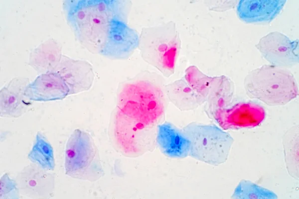 Células Epiteliais Escamosas Sob Visão Microscópica Para Estudo Histológico Histológico — Fotografia de Stock