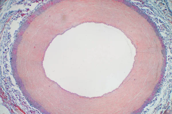 Slagader Bloedvat Onder Microscoop Uitzicht Voor Het Onderwijs Histologie Histologisch — Stockfoto