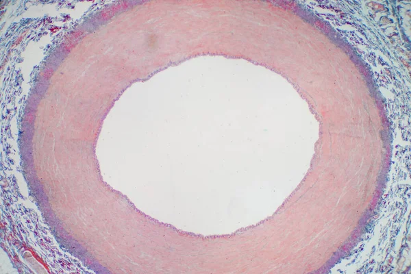 Artärblodkärl Mikroskop Syn För Utbildning Histologi Histologisk För Människans Fysiologi — Stockfoto