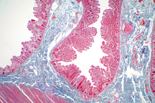 Jaringan Usus Besar Manusia Bawah Pengawasan Mikroskop Histologi Untuk Fisiologi — Stok Foto