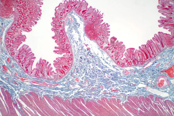 Tecido Intestinal Grosso Humano Sob Visão Microscópica Histológico Para Fisiologia — Fotografia de Stock